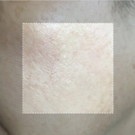 LOVILDS TX Cream - Intensive Repairing Whitening and Spot-Removing Face Cream image LOVILDS TX Cream - Intensive Repairing Whitening and Spot-Removing Face Cream