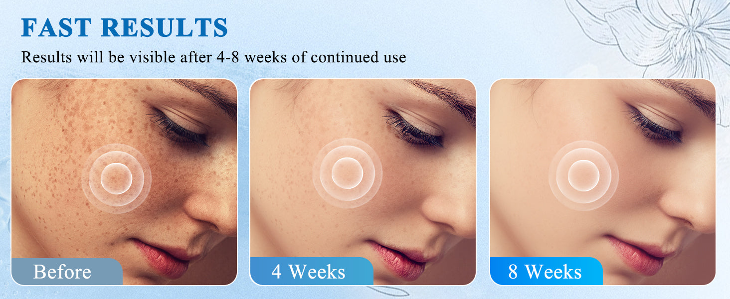 LOVILDS TX Cream - Intensive Repairing Whitening and Spot-Removing Face Cream image LOVILDS TX Cream - Intensive Repairing Whitening and Spot-Removing Face Cream