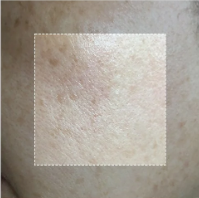 LOVILDS TX Cream - Intensive Repairing Whitening and Spot-Removing Face Cream image LOVILDS TX Cream - Intensive Repairing Whitening and Spot-Removing Face Cream